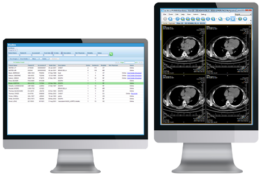 Free ris pacs software